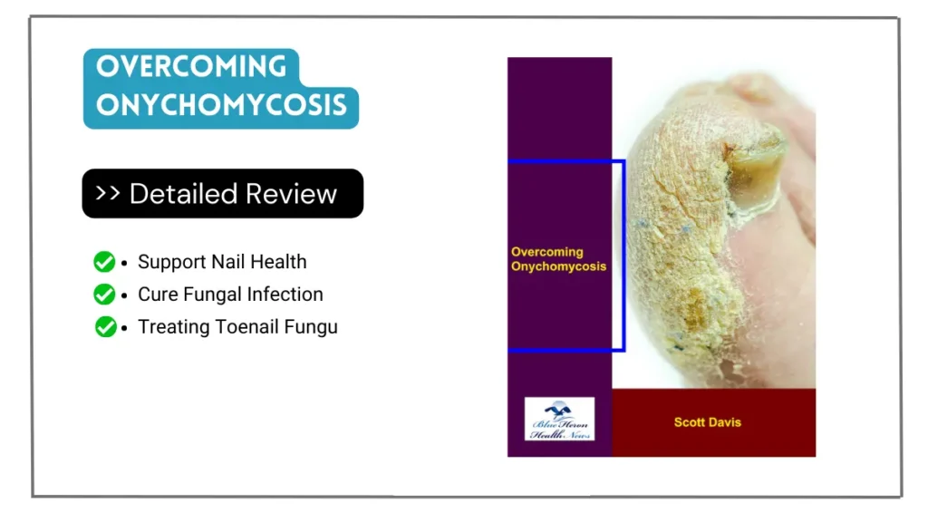 Overcoming Onychomycosis Reviews