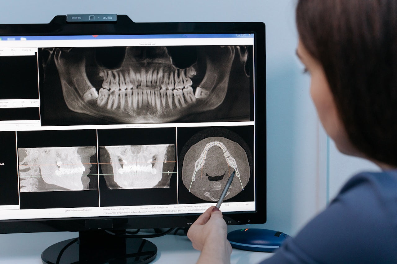 Dental X rays